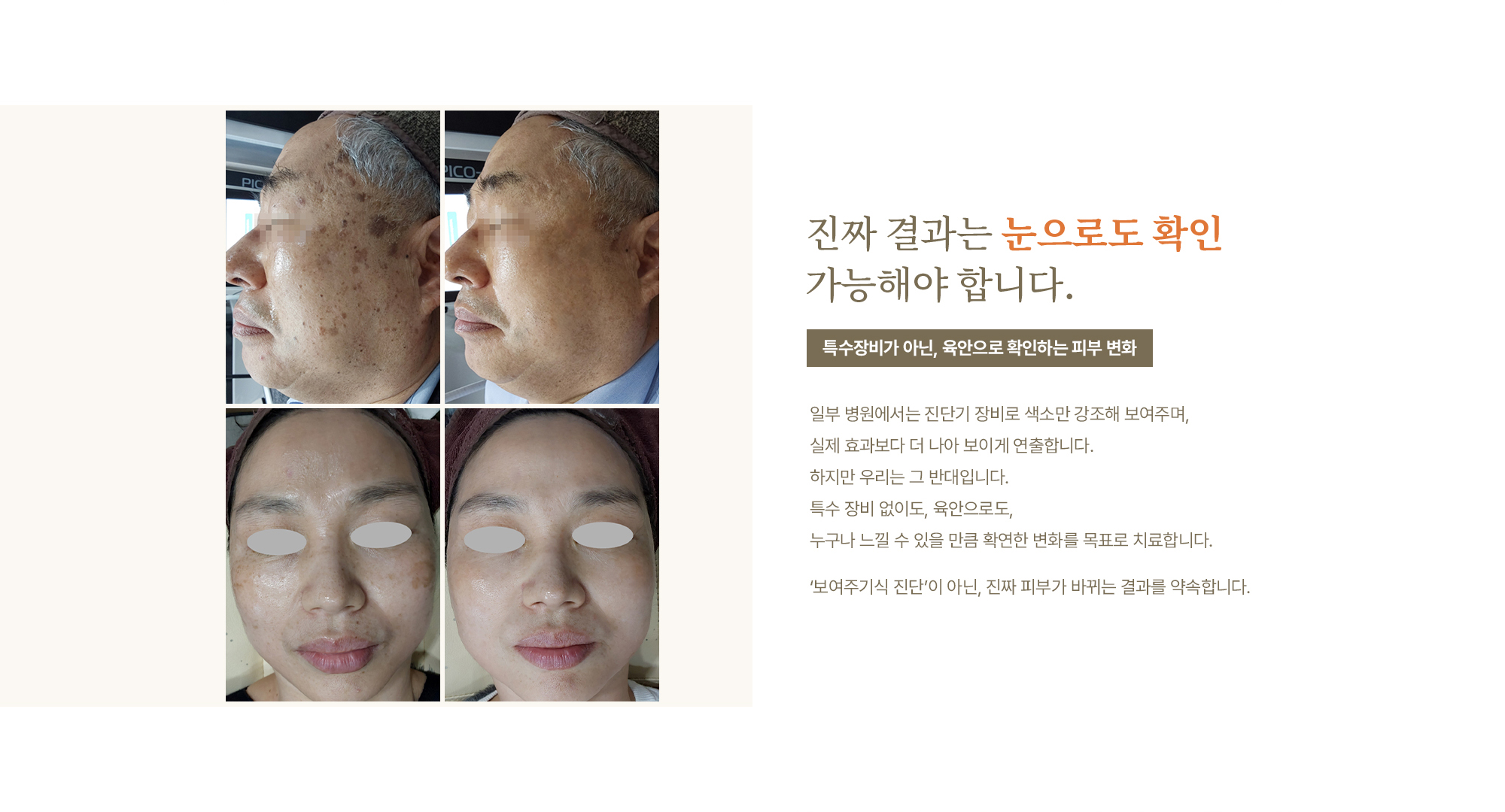 색소