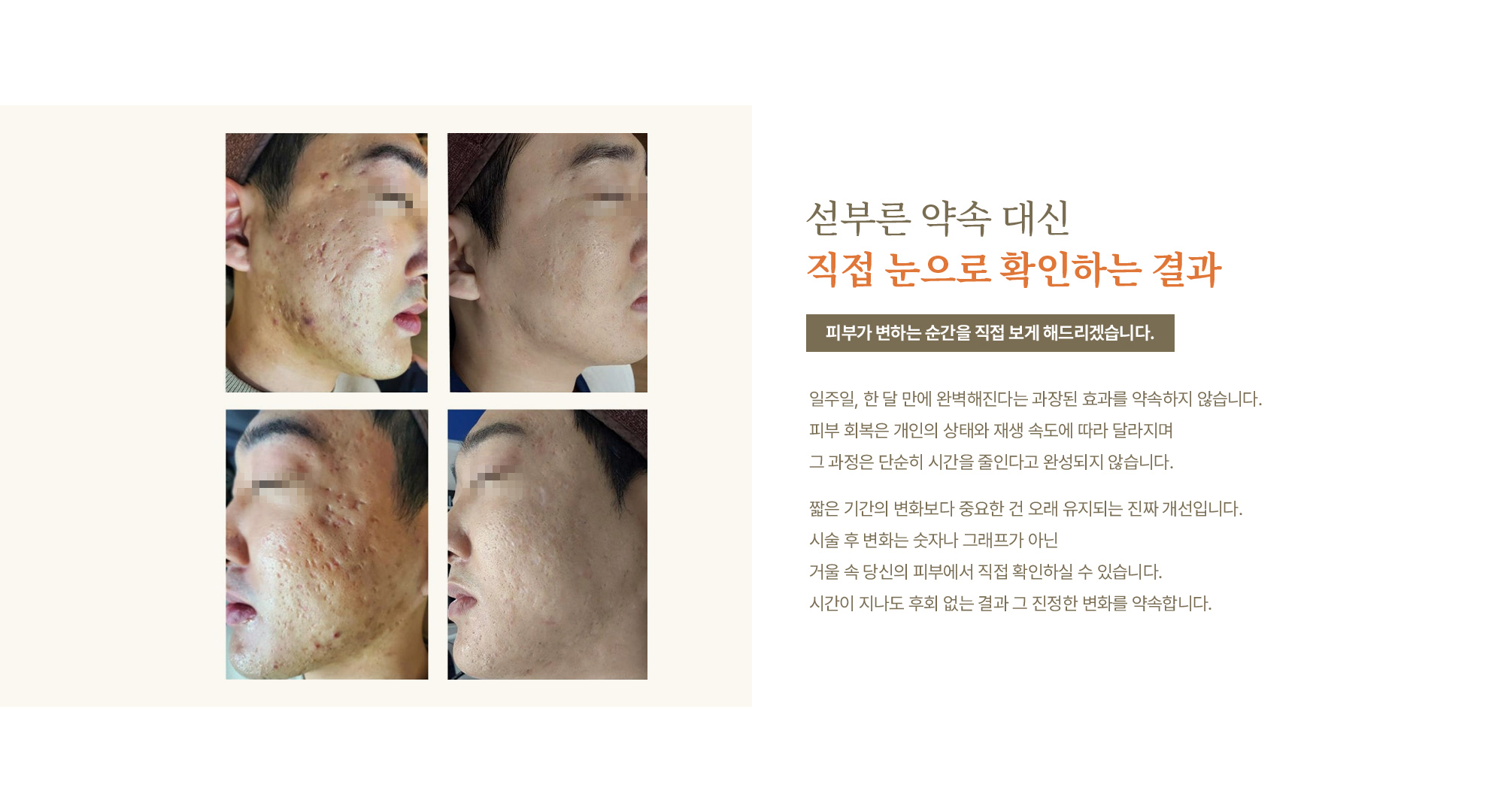 흉터/모공